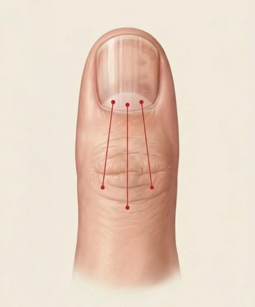 Why Nail Ridges Could Reveal More About Your Health Than You Think
