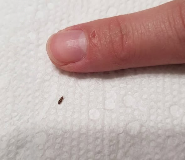 Tiny Bug Found in Toddler’s Hair? What Parents Should Know About Head Lice