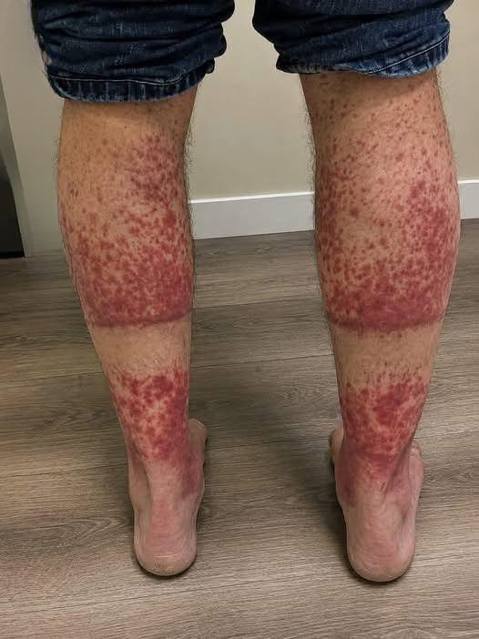 Simple Causes Behind Skin Changes on the Legs and Tips for Better Skin Care