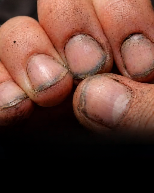 What Dirty Fingernails Can Really Reveal About a Person