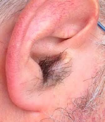 The Real Reason Hair Grows in Your Ears — What Causes It and What It May Say About Aging
