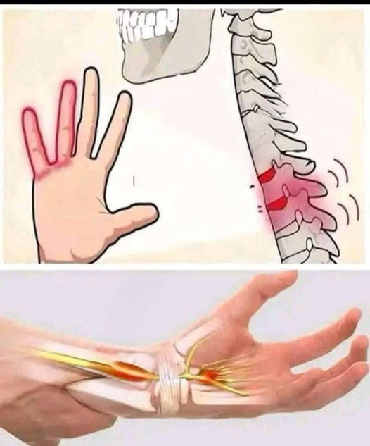 Why You Should Never Ignore Repeated Tingling or Numbness in Your Hands and Feet