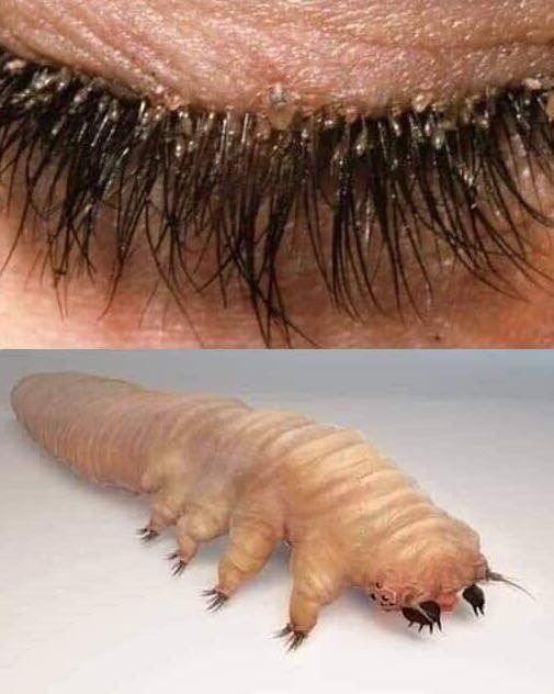 How to Recognize Possible Signs of Eyelash Mites