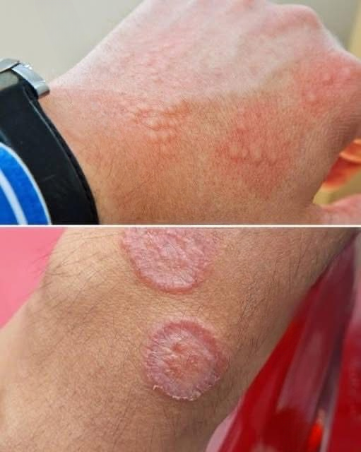 Common Skin Conditions and the Signs You Shouldn’t Ignore