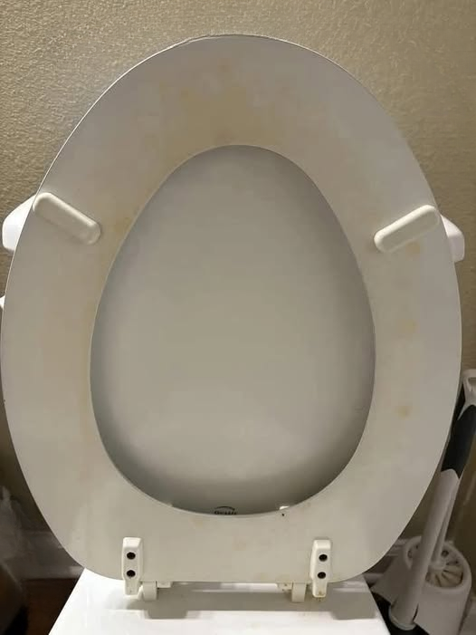 That Stubborn Yellow Toilet Ring? Here’s How to Remove Toilet Stains Safely