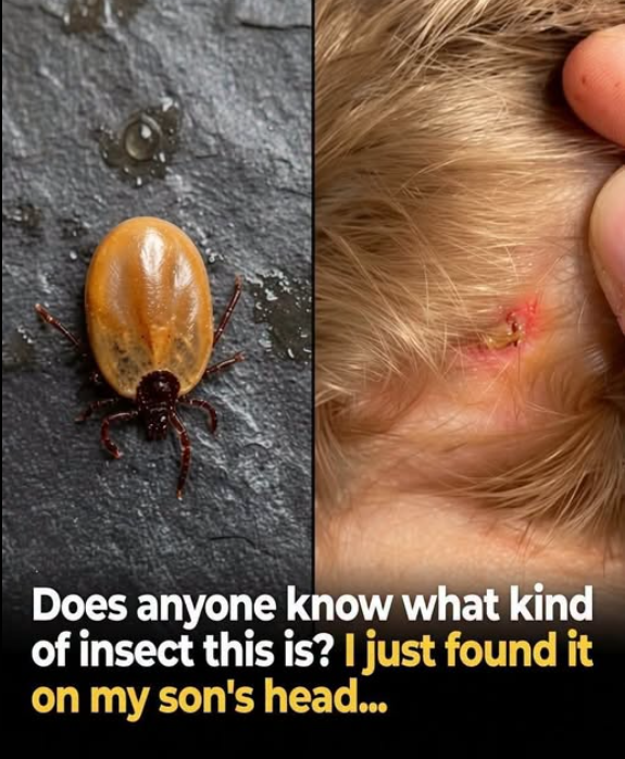 What Parents Should Know About Ticks: Safe Removal, Prevention, and Warning Signs